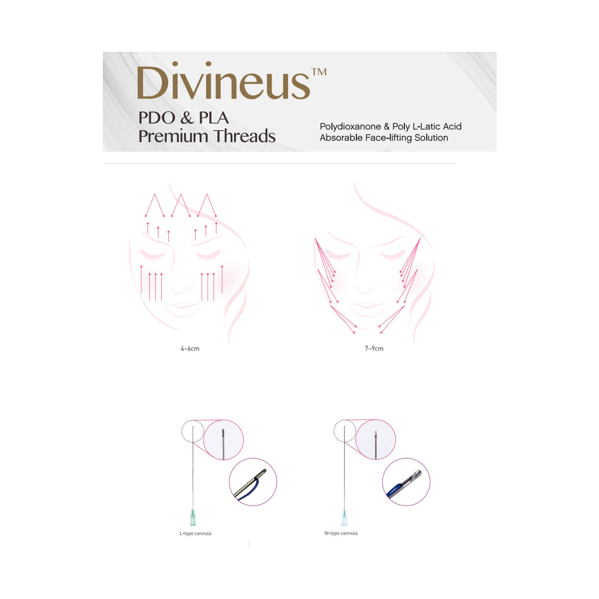 Divineus PDO Moulding (Döküm) Cog Threads